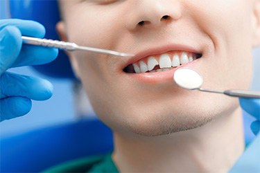 Repair cavities and broken teeth near Upper Arlington.