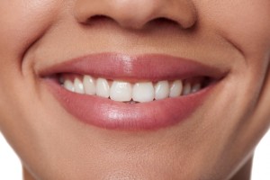 tooth contouring