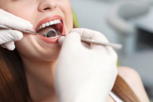 woman in dentist chair mouth open