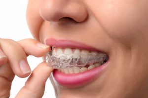 woman smiling while inserting invisalign tray