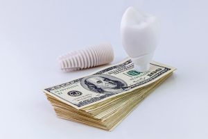 dental implant on money