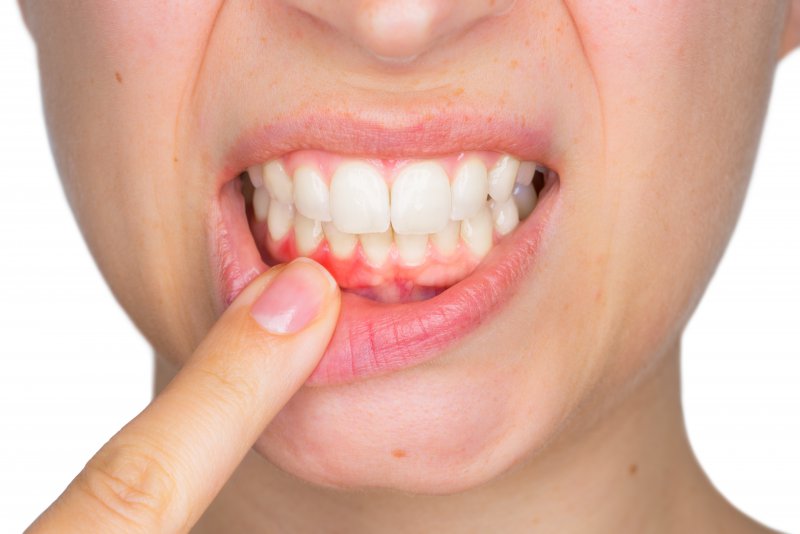 woman showing pink spot on gums