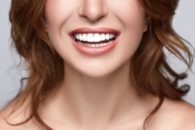 Woman after teeth whitening in Upper Arlington