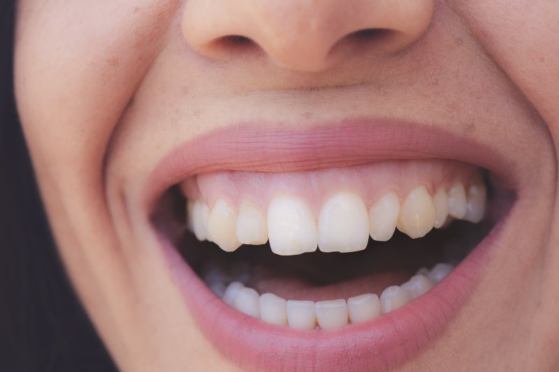 Woman showing off gums