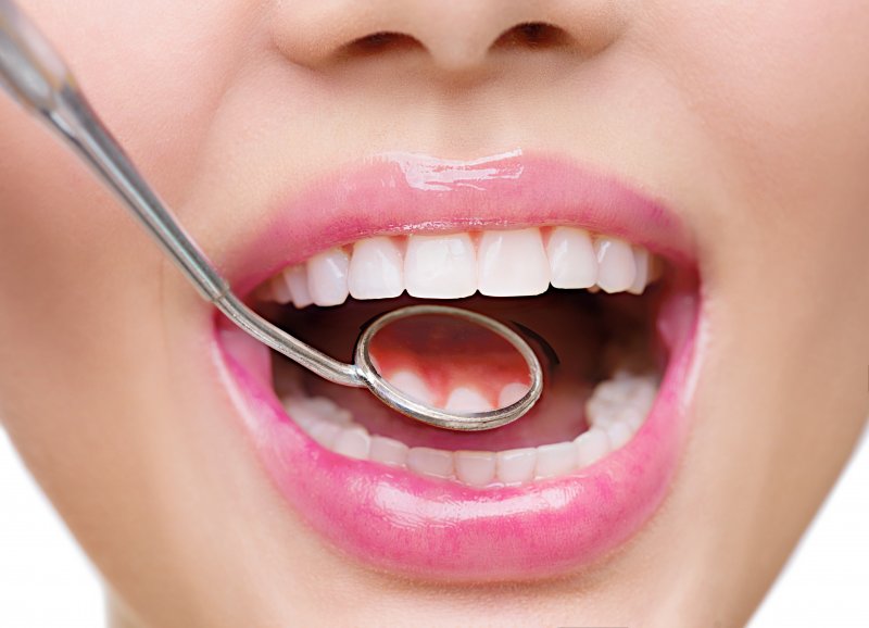 close up of dental mirror checking oral health