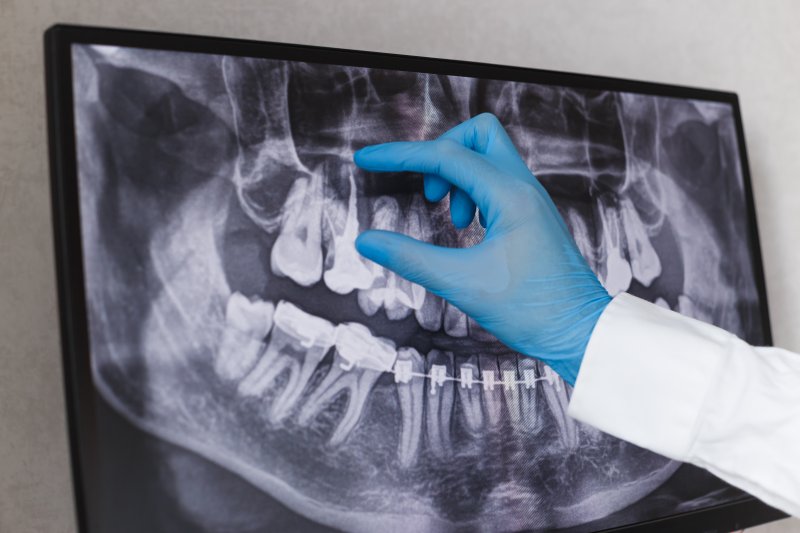 Dentist looking at dental x-rays